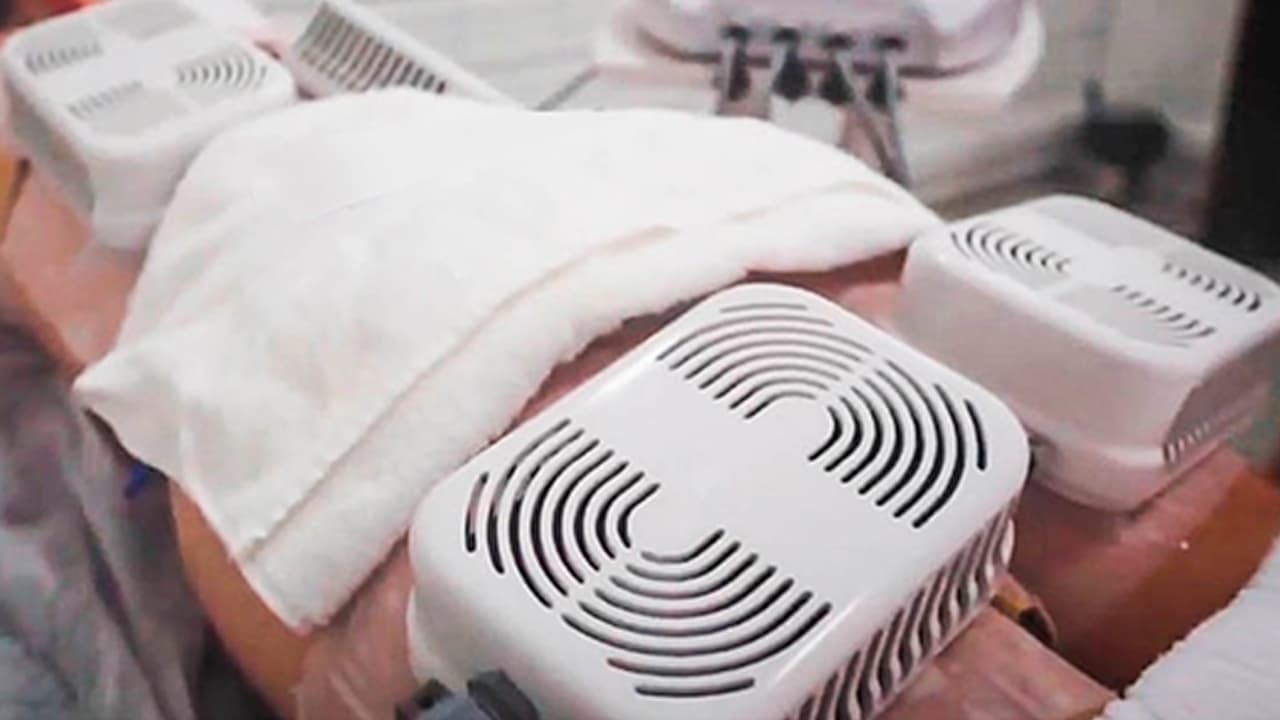 Workshop gravado - ATUALIZAÇÃO EM CRIOLIPOLISE DE PLACAS: NOVOS ESTUDOS CIENTÍFICOS