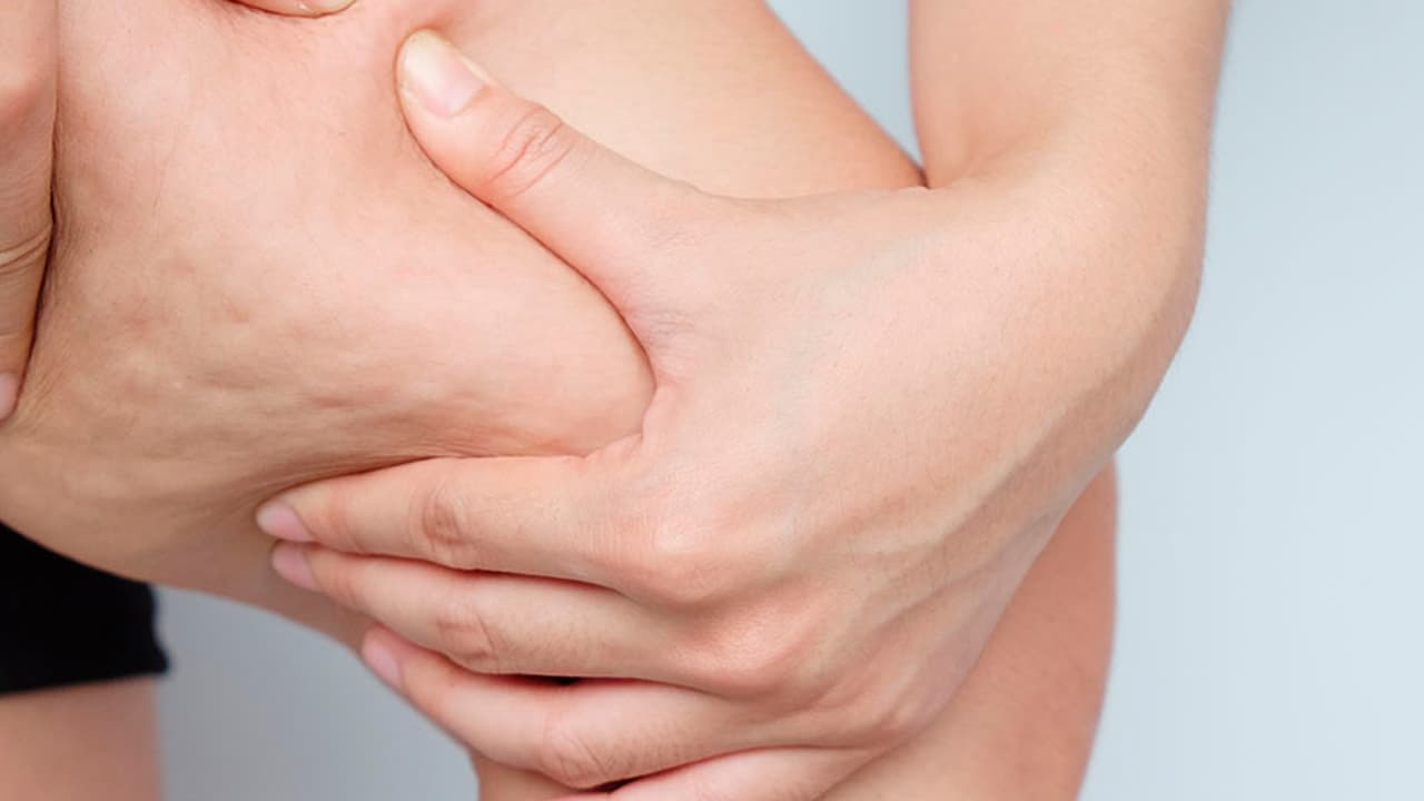 Workshop registrato - GLI ULTRASUONI NEL TRATTAMENTO DELLA CELLULITE E DEL GRASSO LOCALIZZATO: PROTOCOLLI CLINICI