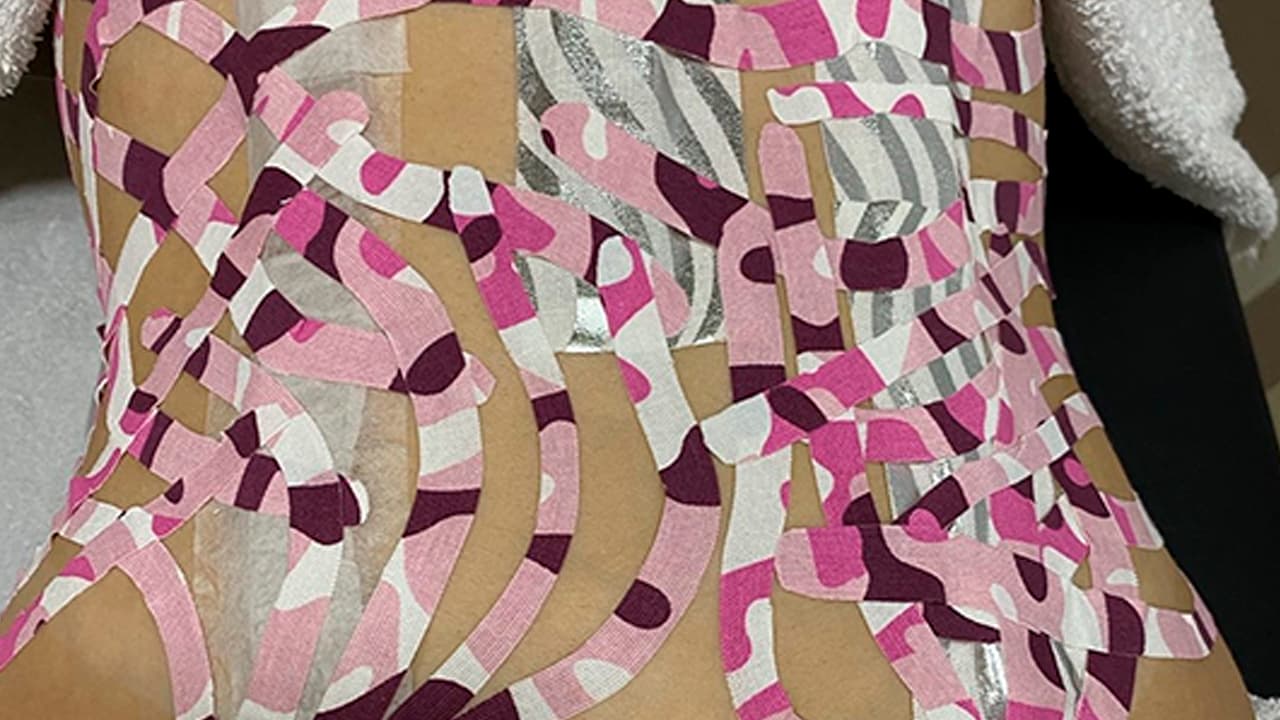 Workshop grabado - VENDAJES FUNCIONALES EN EL POSTOPERATORIO DE CIRUGÍA PLÁSTICA