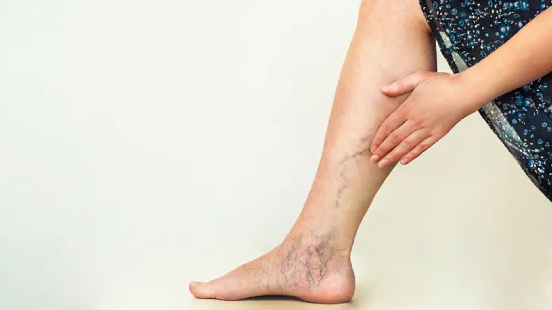 Workshop gravado - COMO ATUAR NO PÓS-OPERATÓRIO DAS CIRURGIAS VASCULARES?